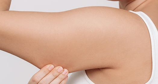 Arm Fat Reduction