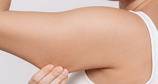 Arm Fat Reduction
